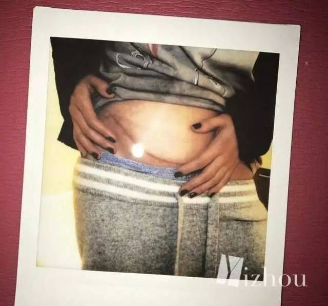 换肾明星的科技重生，体验未来新生活，重塑生命奇迹