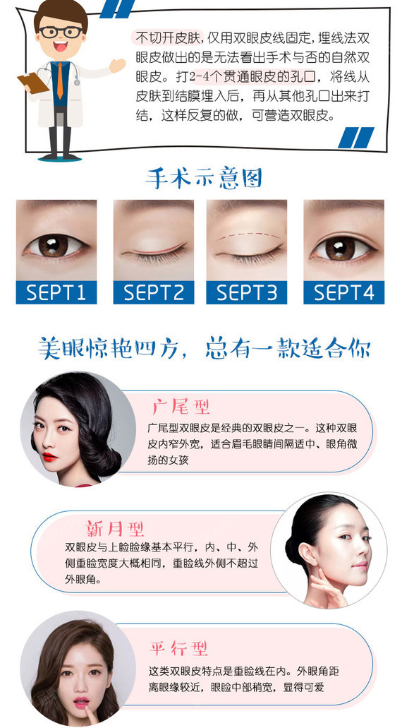 最新双眼皮术，自然双眼皮美景的探寻之旅